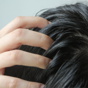 Cabello Graso