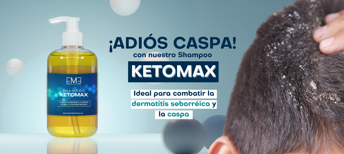 ¡ADIÓS CASPA!